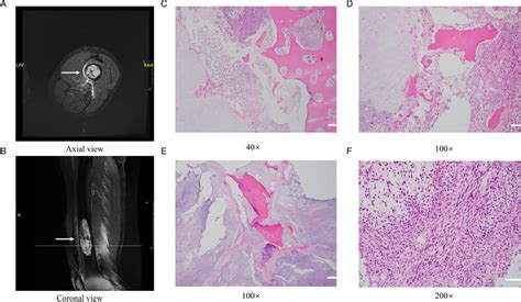 Clinical Characteristics Of The Dedifferentiated Chondrosarcoma Donor Download Scientific