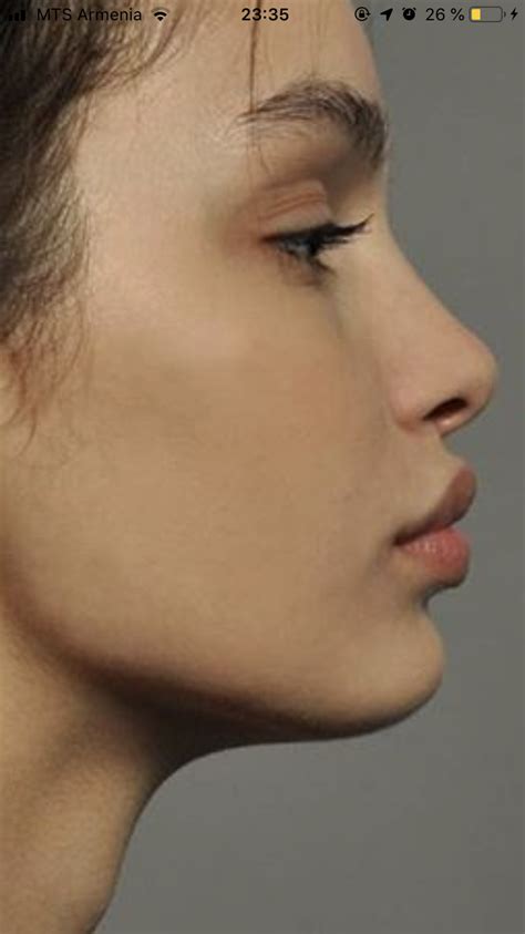 Pin by Artist MC on 인물 | Pretty nose, Rhinoplasty nose jobs, Nose job