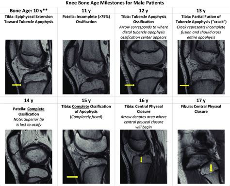 Shorthand Magnetic Resonance Imaging MRI Knee Bone Age Algorithm For