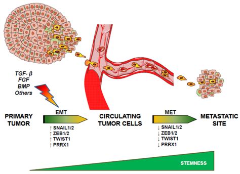 JCM Free Full Text New Insights Into The Crossroads Between EMT And