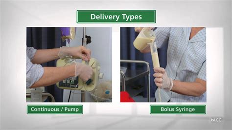 Types Of Enteral Feeding