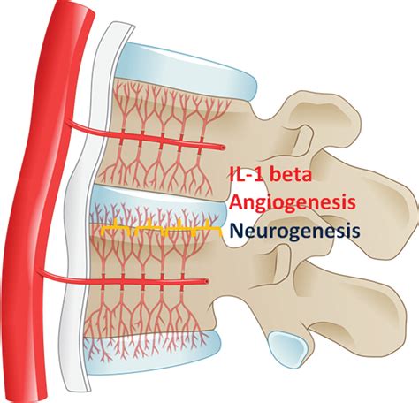 Mechanisms And Origins Of Spinal Pain From Molecules To Anatomy With