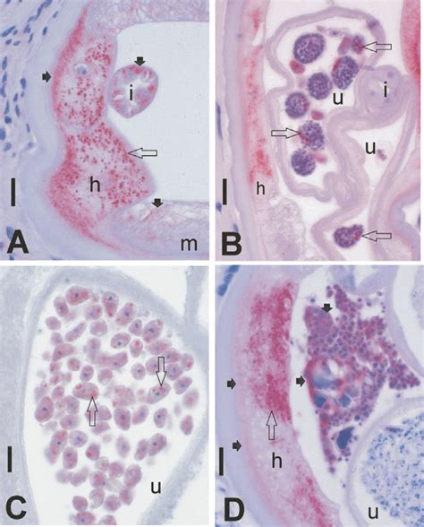 Immunohistochemical Labelling Of Hsp60 In Wolbachia Endobacteria And In