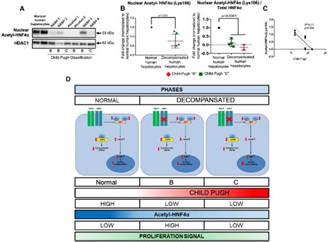 Acetylation of nuclear HNF4α is altered in human decompensated