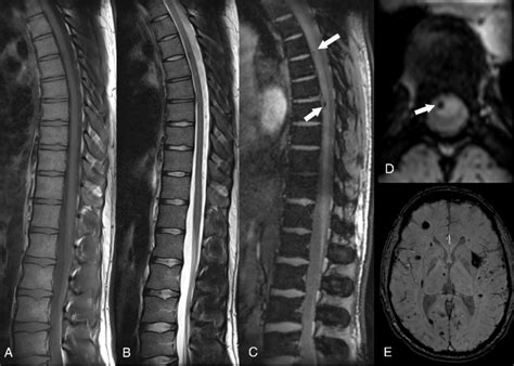 Sagittal T Tse A Sagittal T Tse B Sagittal D Medic C And