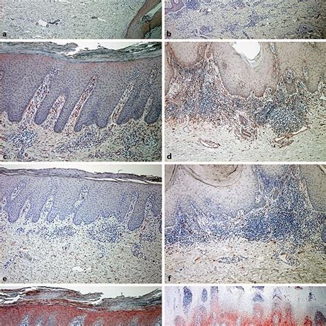 Representative Figures Of Immunohistochemical Staining For 5 Historical