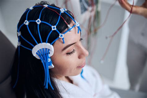 El Electroencefalograma Eeg Una Ventana Cerebral