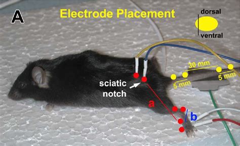 The Effects Of Anesthesia On Measures Of Nerve Conduction Velocity In