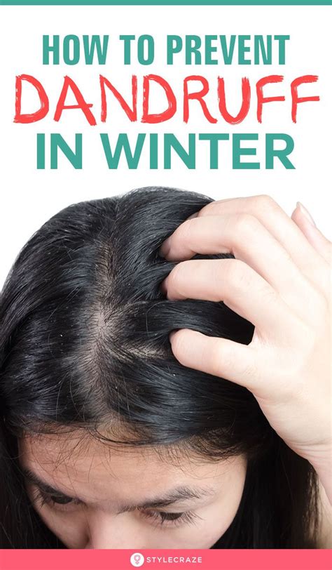 Dandruff In Winter Ways To Prevent It Naturally How To Prevent