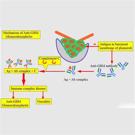 Anti Glomerular Basement Membrane Gbm Antibody Test Gdic