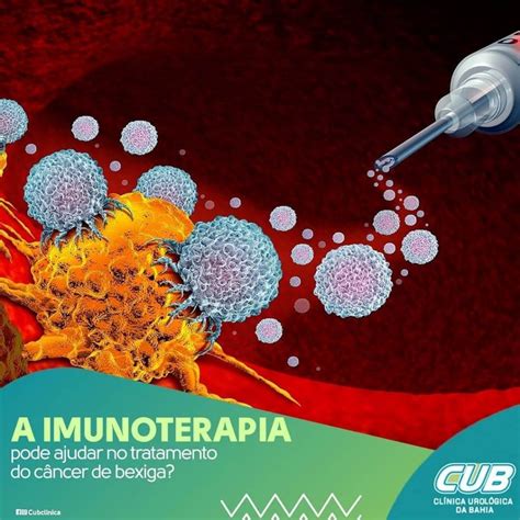 Imunoterapia pode ajudar no tratamento do Câncer de Bexiga CUB