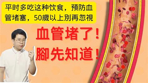 血管堵了，腳先知道！腳上出現這4種現象，暗示血管已經很臟了！平时多吃这种饮食，預防血管堵塞，50歲以上別再忽視 Youtube