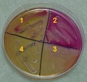 MacConkey Agar Alchetron The Free Social Encyclopedia