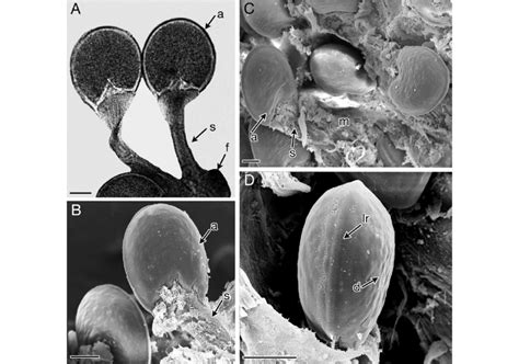 Petrochirus Diogenes Spermatophore Morphology A General Morphology