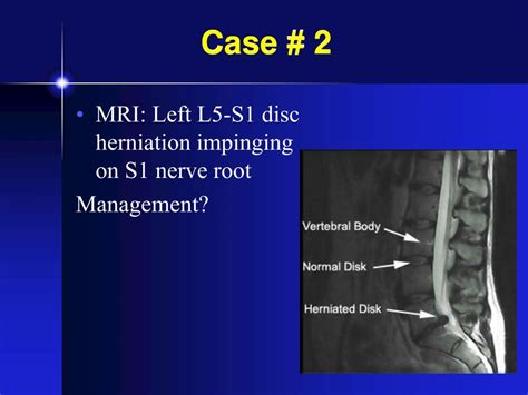 Ppt Low Back Pain Case Based Evaluation And Management Powerpoint