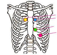 Heart Sound locations flashcards | Quizlet