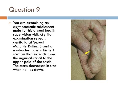 Human Testicle Cut In Half Telegraph