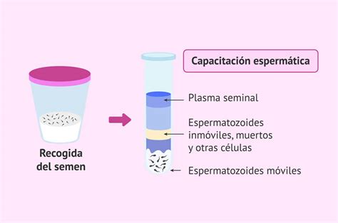 Capacitación Espermática Embryofertility Clínica Fertilidad Lima