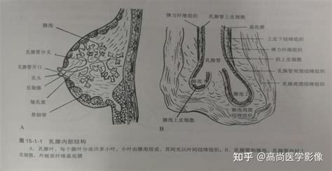 年轻女性乳腺癌三例【高尚医学影像】 知乎