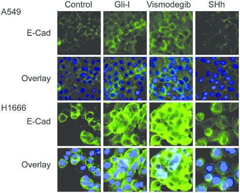 Shhgli Signaling Reduces E Cadherin Expression Immunofluorescent