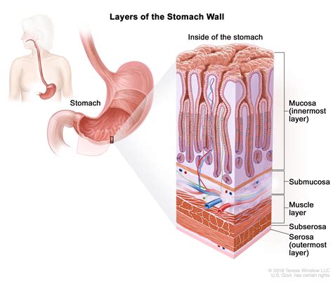 Stages of Stomach Cancer - NCI