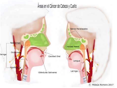 Cáncer de Cavidad Nasal y Seno Paranasal Tratamiento Asociación de