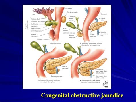 Ppt Chapter 23 Development Of Digestive And Respiratory System Powerpoint Presentation Id