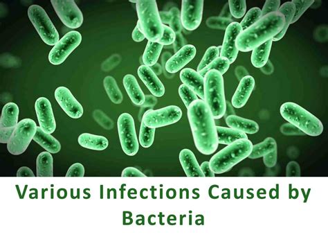 PPT - Diseases Caused by Bacterial Infections PowerPoint Presentation ...