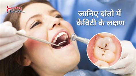 Cavity Symptoms: दांतों में होने वाली कैविटी के क्या होते हैं प्रमुख लक्षण