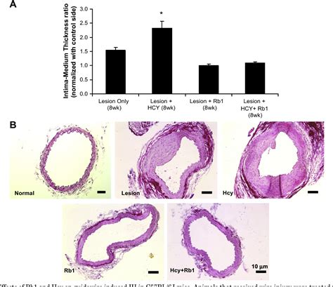 Figure From Ginsenoside Rb Attenuates Homocysteine Augmented