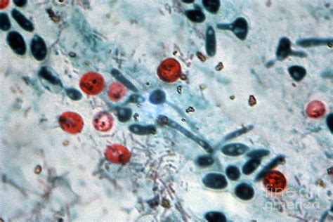 Cryptosporidium Oocysts Lm Photograph By Science Source Fine Art America