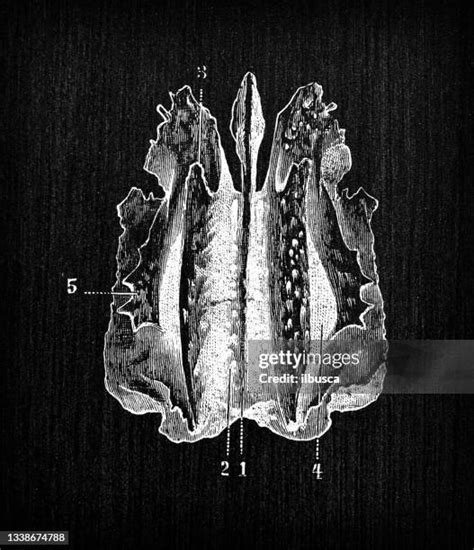 Ethmoid Photos And Premium High Res Pictures Getty Images