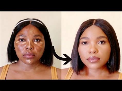 COVER HYPERPIGMENTATION AND MELASMA WITHOUT FOUNDATION LOREAL