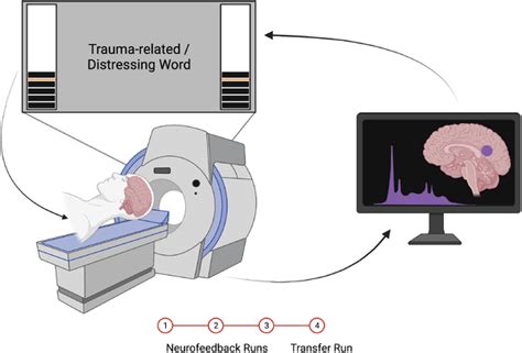 Schematic Of The Realtime FMRI Neurofeedback Setup Brain Activity In