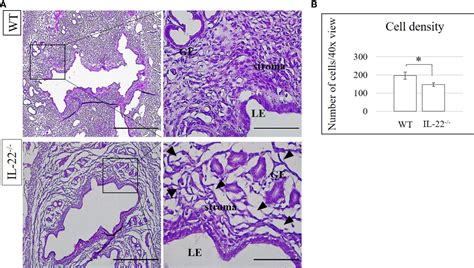 Frontiers Il 22 Regulates Endometrial Regeneration By Enhancing Tight