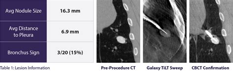 Tool In Lesion” Accuracy Of Galaxy System A Robotic Electromagnetic