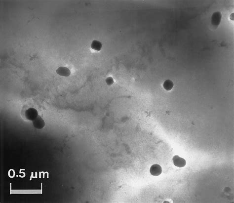 tem micrograph  larger particles  scientific diagram