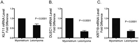 Mrna Levels Of Klf11 Dlec1 And Krt19 In Uterine Leiomyoma And Matched Download Scientific