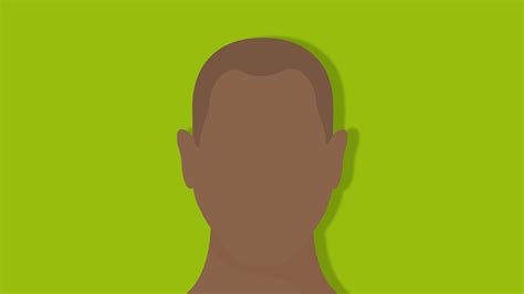 What Illnesses Cause Hair Loss Lloyds Online Doctor Ie