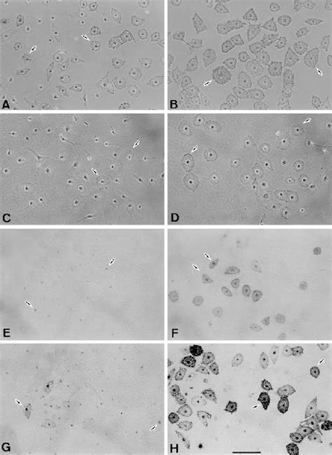 Melanoblasts And Melanocytes In Pure Cultures Derived From Epidermal