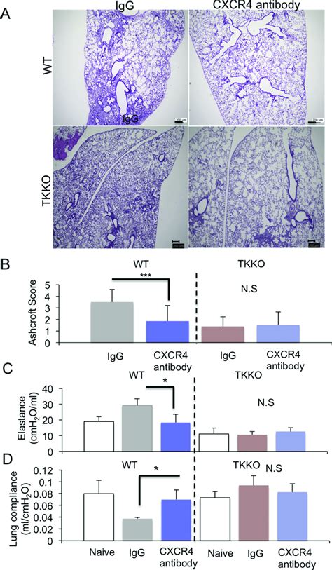 Vegfr Tk Signaling Induces Pulmonary Fibrosis Through The Sdf Cxcr