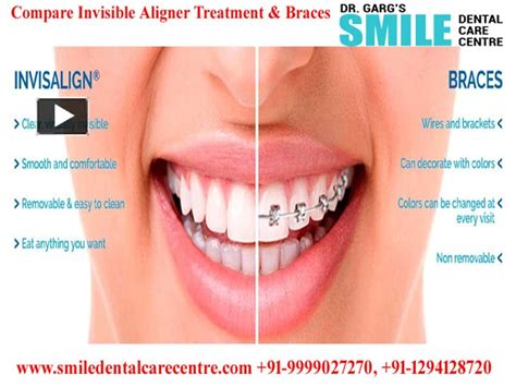 Ppt Painless Root Canal Treatment Bytop Dentist In Faridabad