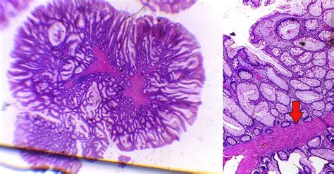 GASTROINTESTINAL AND LIVER HISTOLOGY PATHOLOGY ATLAS: COLON ...