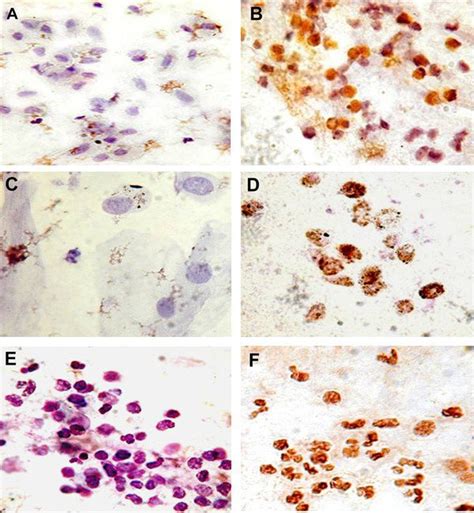 Photomicrographs Showing Nrf Protein Expression In The Nuclei Of