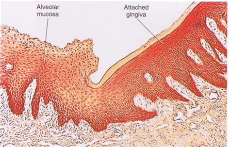 Oral Mucosa Flashcards Quizlet