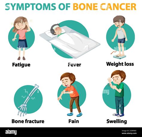 Medical Infographic Of Bone Cancer Symptoms Illustration Stock Vector Image And Art Alamy