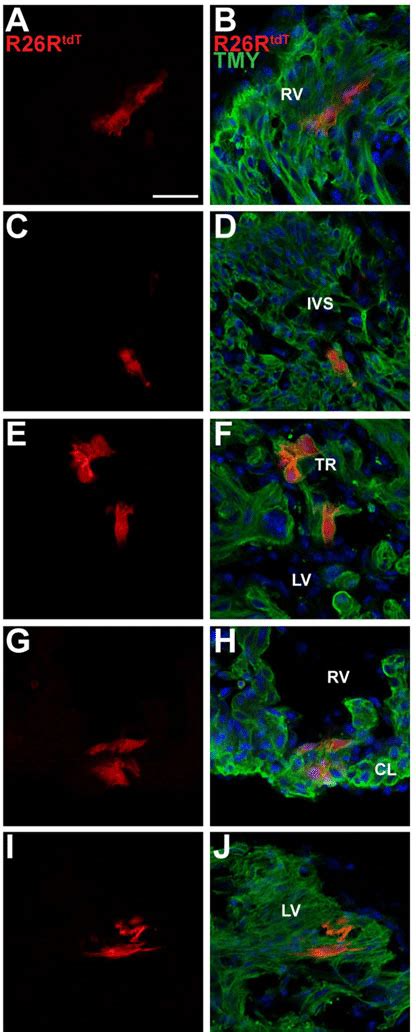 Lineage Tracing With Casz1 Creert2 Neo Labels Cardiomyocytes In First