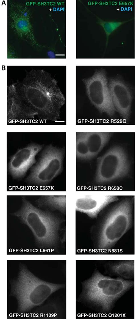 Intracellular Localization Of Sh3tc2 A Rat Schwann Cells Transiently