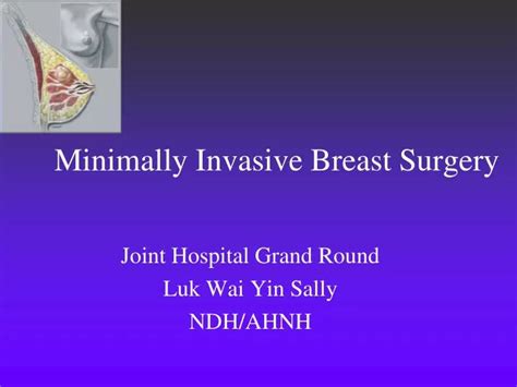 Ppt Minimally Invasive Breast Surgery Powerpoint Presentation Free