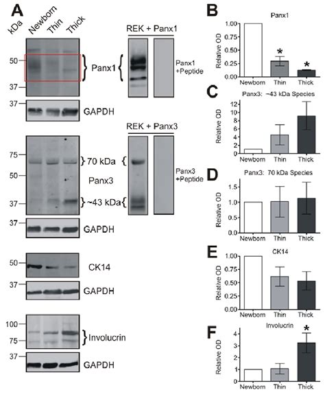 Panx But Not Panx Expression Levels Decrease In Aging And Thickened